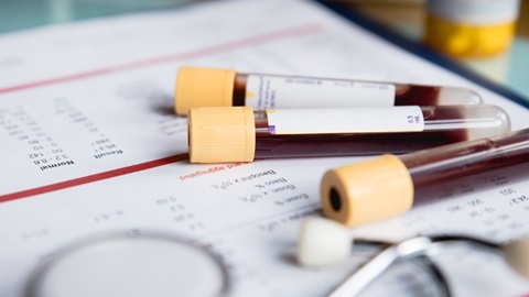 Les suppléments facturés par les laboratoires pour des analyses sont-ils autorisés ?